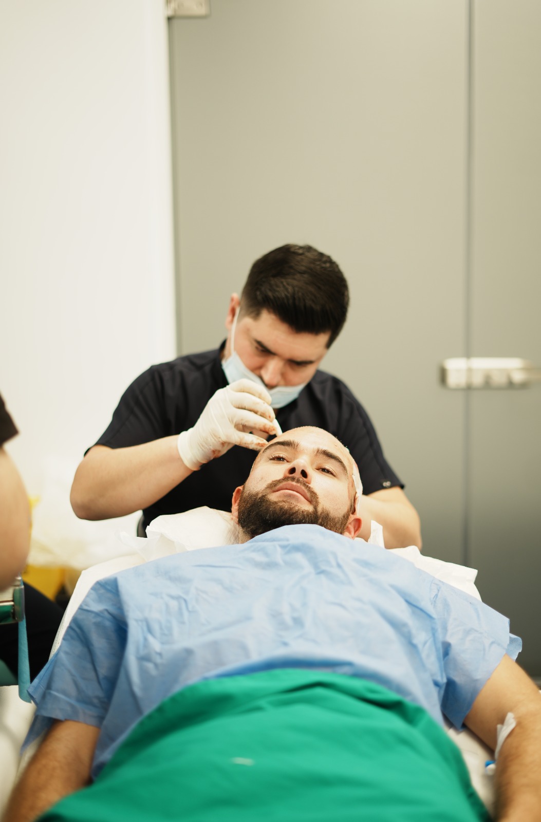Hair transplant result
